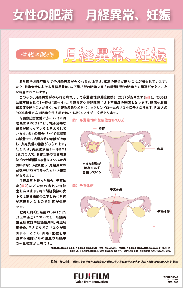 女性の肥満　月経異常、妊娠